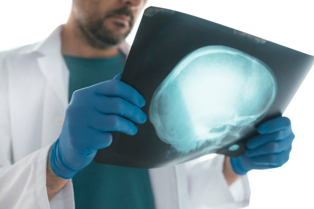 accidents involving brain injury