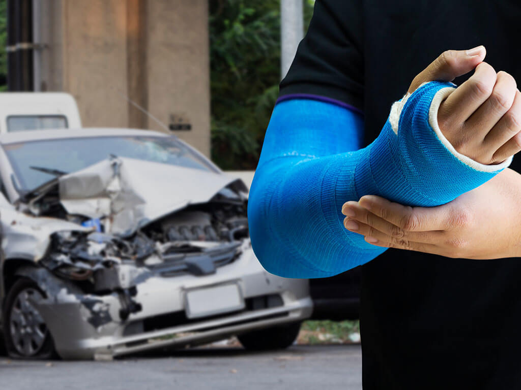 Fractures from Accidents: What to Do and How Caputo & Mariotti Can Help